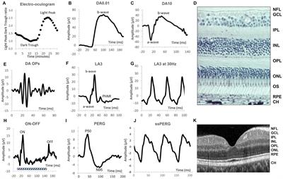 Retinal electrophysiology in central nervous system disorders. A review of human and mouse studies